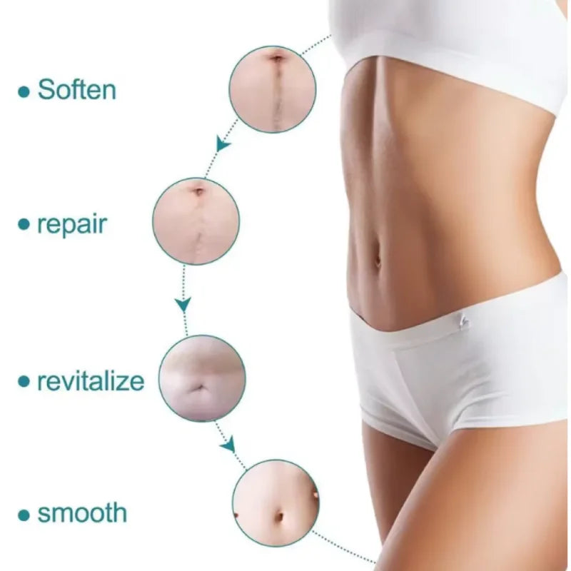 Silicone Scar Repair Tape – C-Section, Surgery & Burn Scar Treatment